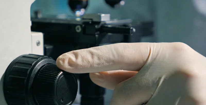 医生正在观看胸腔积液患者的胸部