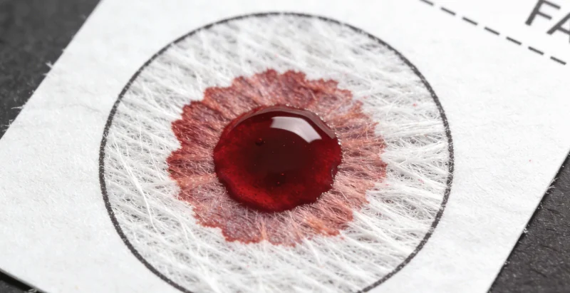 济宁某医院内,患者正在接受腹部