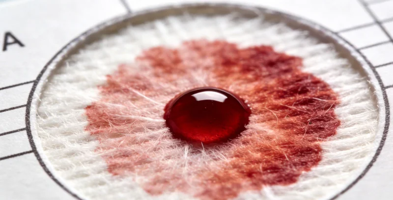 医护人员规范采集血液或肺泡灌洗