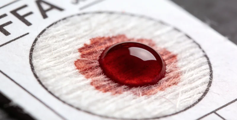 展示从样本采集到出具报告的流程