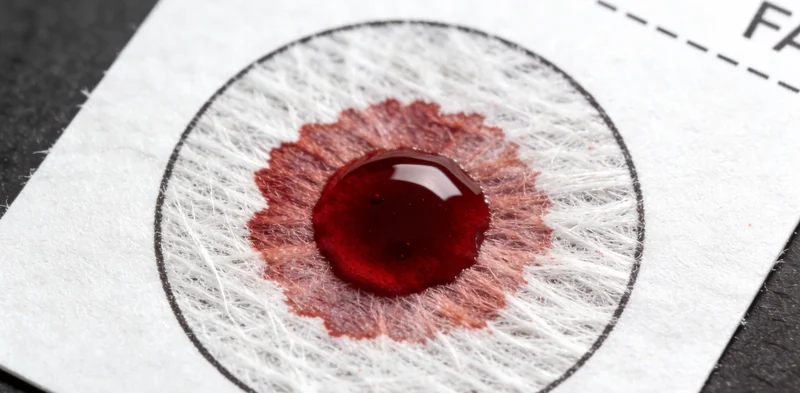 一位护士正在为患者进行静脉采血