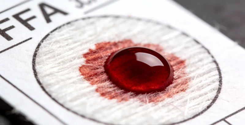 医护人员正在规范采集脑脊液样本