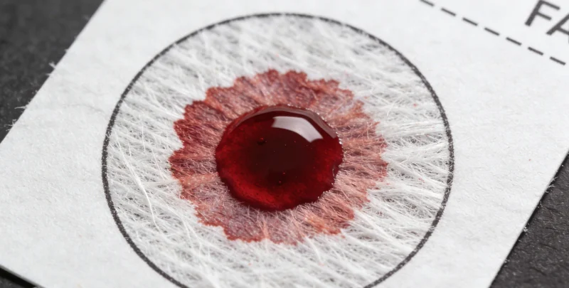 专业人员正在进行基因检测样本采