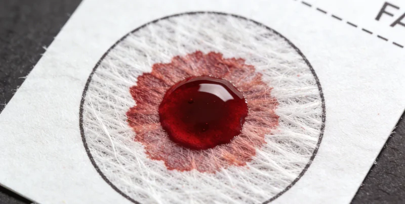 真菌基因检测流程图解