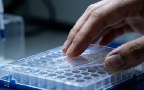 大连胰腺癌基因检测去哪里检测