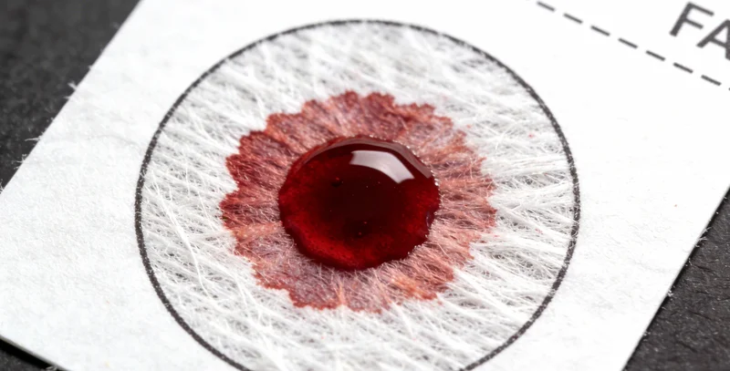 HSV基因检测样本采集过程