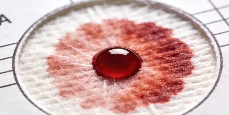 医护人员正在进行肺泡灌洗液样本