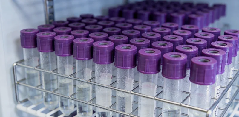 专业人员演示正确的鼻咽拭子样本