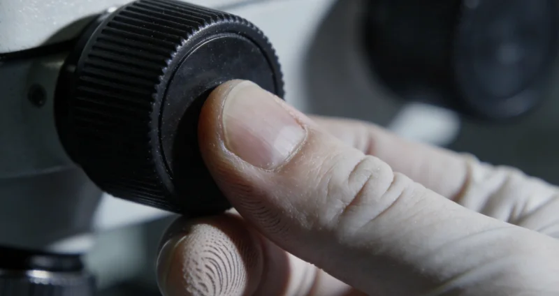 单纯疱疹病毒(HSV)的微观结