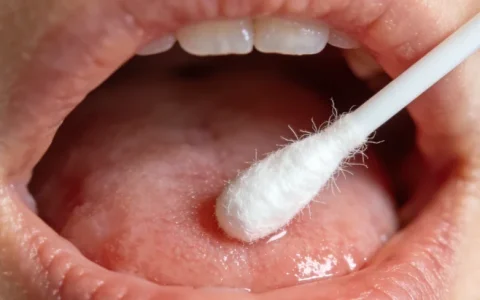 赤峰RNA mNGS基因检测十大排名