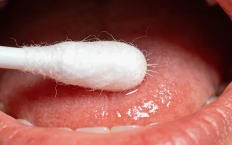 连云港病毒性脑炎基因检测去哪里检测