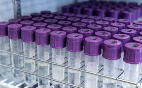 盐城卵巢癌基因检测专业机构地址