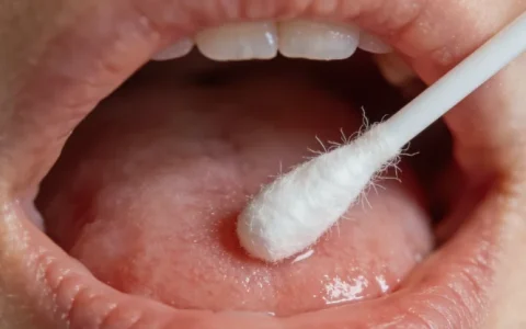 蚌埠HSV基因检测哪个公司最好