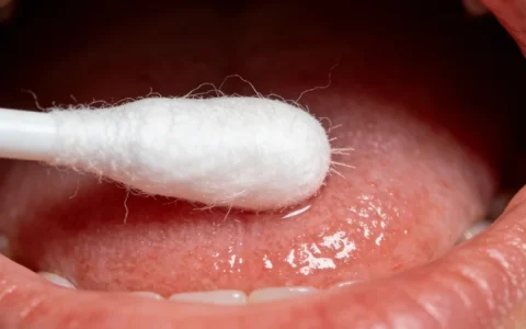 鹤岗胃癌基因检测哪里比较靠谱