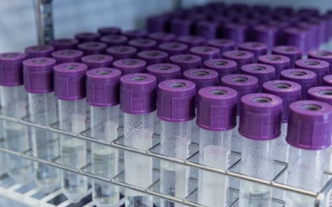 丽江前列腺癌基因检测去哪做比较好