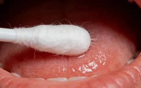 包头CMV基因检测受理中心