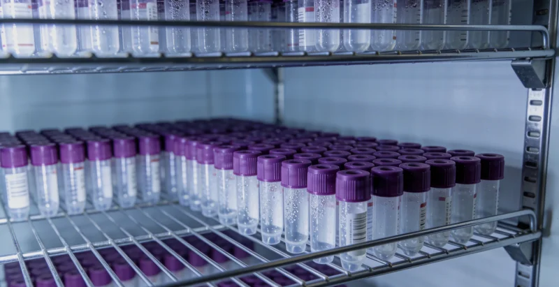 电子显微镜下曲霉菌的形态,展示