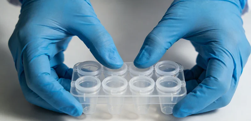 隐球菌基因检测全流程解析图