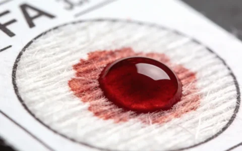 白银结核分枝杆菌mNGS基因检测权威指南：正规机构全名单与选择建议