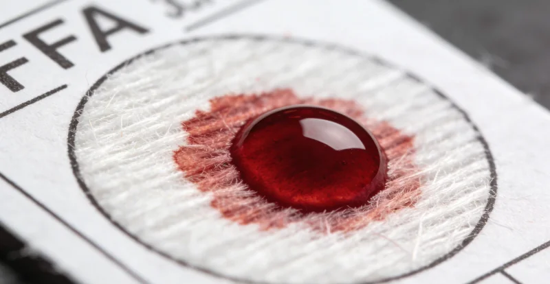 腹泻基因检测采样管使用演示