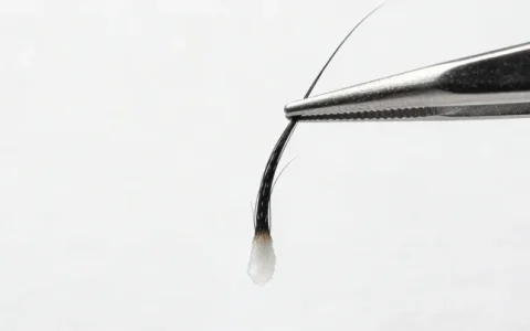 定西肺孢子菌基因检测公司查询