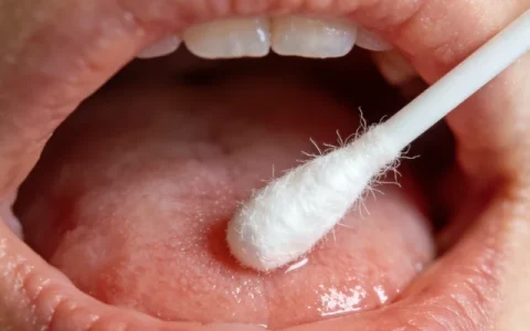 永州血液肿瘤基因检测在哪个位置