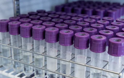 海口病毒性脑炎基因检测哪里正规？一文读懂机构选择与避坑指南