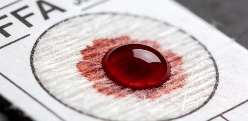 展示腹腔积液医学影像示意图，辅