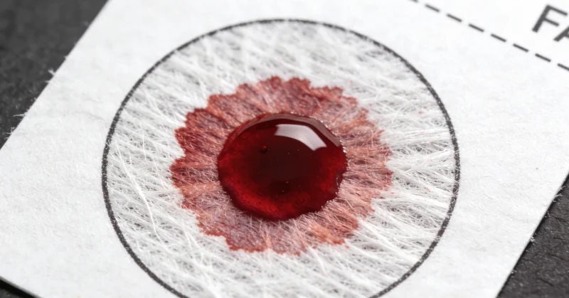 护士正在为一位孕妇采集静脉血样