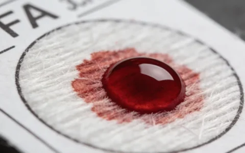 西安寄生虫基因检测机构怎么选？