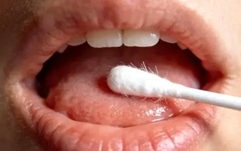 资阳脑炎脑膜炎病原基因检测机构权威指南：最新正规地点盘点与查询方式