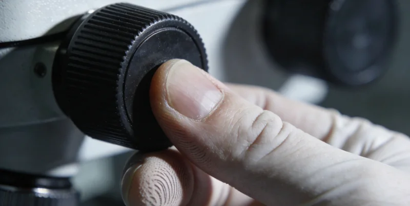 医生正在分析腹腔积液患者的医学