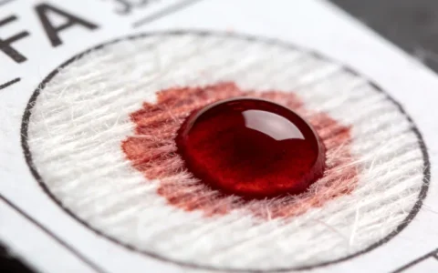 本溪血液肿瘤基因检测机构怎么选？