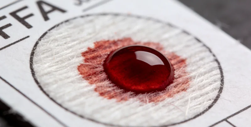 STD基因检测全流程示意图，从