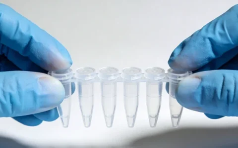 贵阳支原体基因检测机构去哪查？