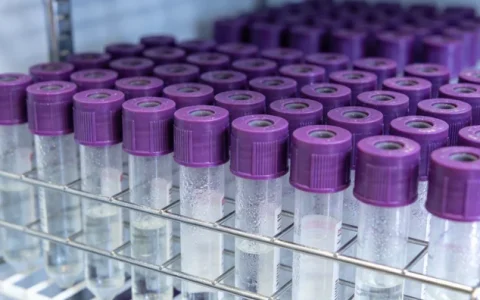 包头脑膜瘤基因检测哪里比较靠谱