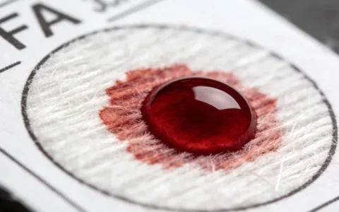 忻州CMV基因检测附近哪里能做