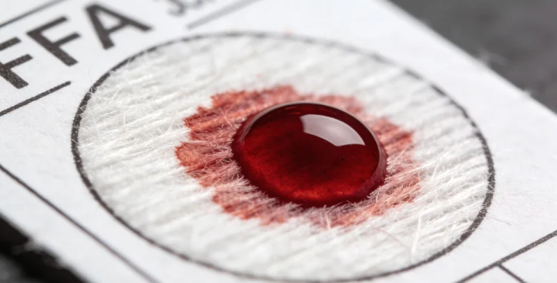 专业医护人员进行样本采集操作