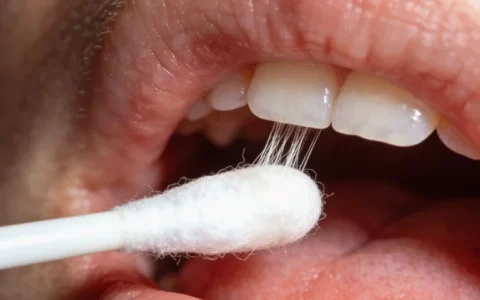 徐州结核分枝杆菌mNGS基因检测攻略：正规检测点、地址、流程一览