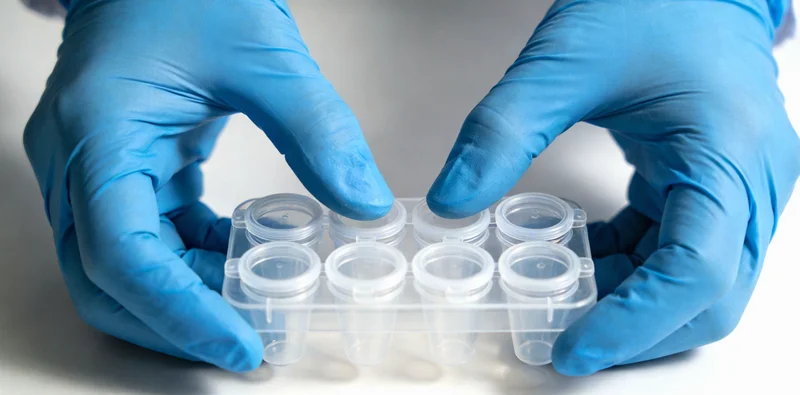 专业人士在实验室分析基因检测报告