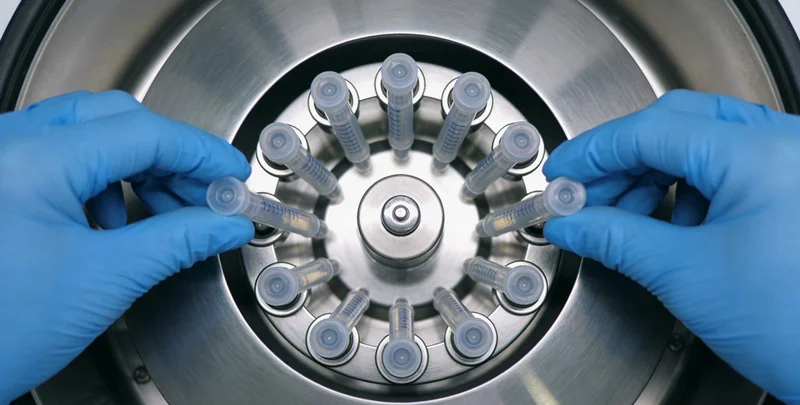 天津医院神经科医生接诊脑肿瘤患