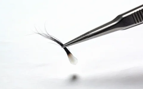 昆明膀胱癌基因检测机构地址