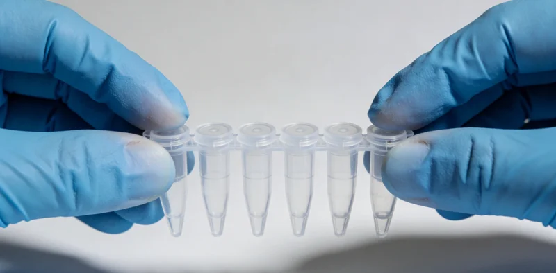 七台河市民在医院咨询脑胶质瘤基因检测的场景