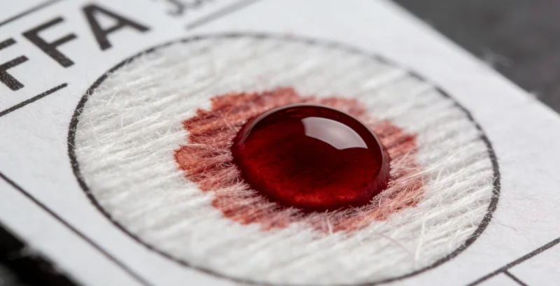 示意图展示DNA mNGS检测