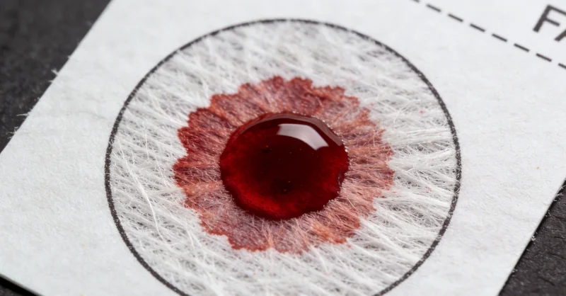 医护人员正在严格按照规范采集检