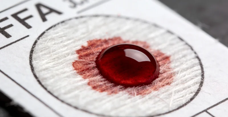 专业人员在实验室进行血液样本处理