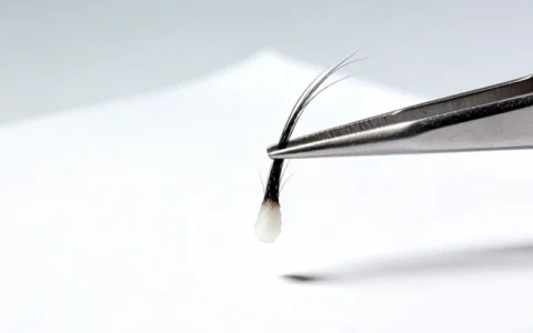 湛江肺泡灌洗液mNGS基因检测详细地址在哪