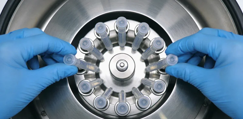 医生检查病毒性脑炎患者的临床场