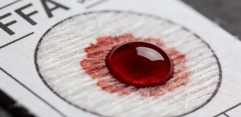 病原体检测样本采集与处理流程