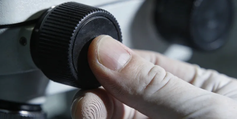 医生正在电脑前认真分析患者的肺